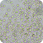 Форменные элементы